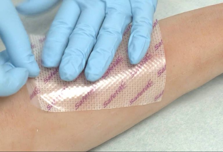 Lee más sobre el artículo Innovación en el Tratamiento de Heridas y Quemaduras