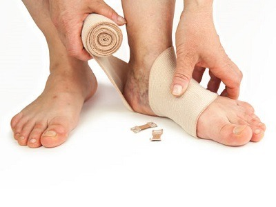 Lee más sobre el artículo Cuidados de una ulcera venosa